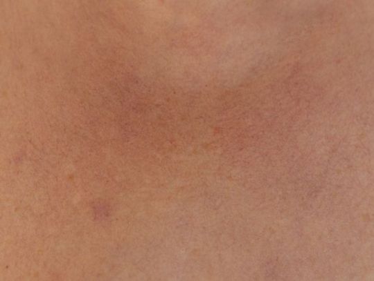 Dlaczego warto odwiedzić dermatologa?