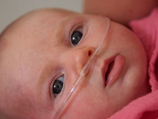 FOTO: Jeszcze lepszy sprzęt, by ratować najmłodszych pacjentów starogardzkiego szpitala