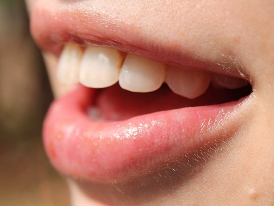 Jak prawidłowo dbać o zęby?