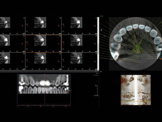 Na czym polega diagnostyka obrazowa w stomatologii?
