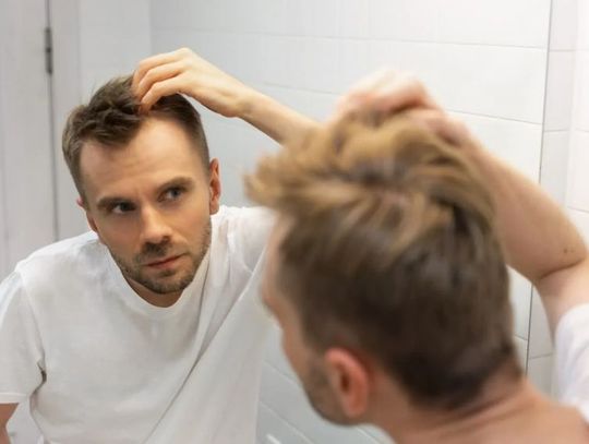 Przyczyny łysienia – analiza mechanizmów i rodzajów łysienia