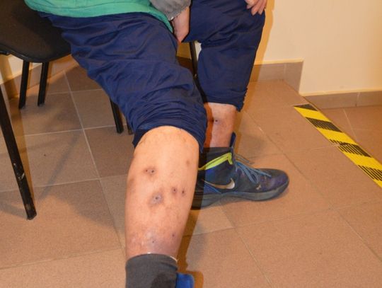 „Te małe muszki  wkrótce zjedzą mnie całego”. Nasz Czytelnik chciał tylko, by ktoś mu pomógł...