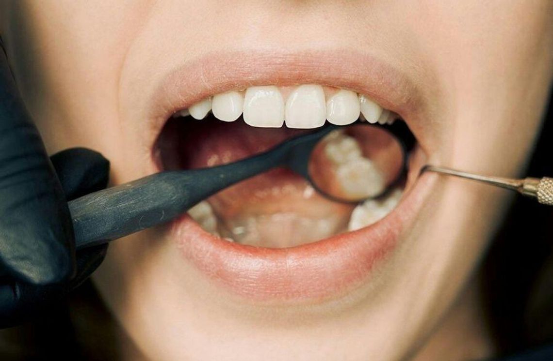 Aparaty stałe – Jak i kiedy z nich korzystać?