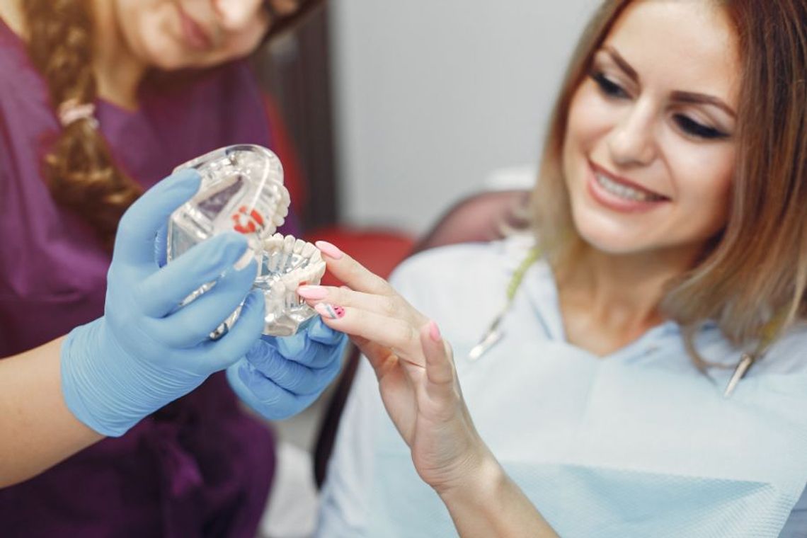 Dlaczego zęby na 4 implantach zdobywają popularność?