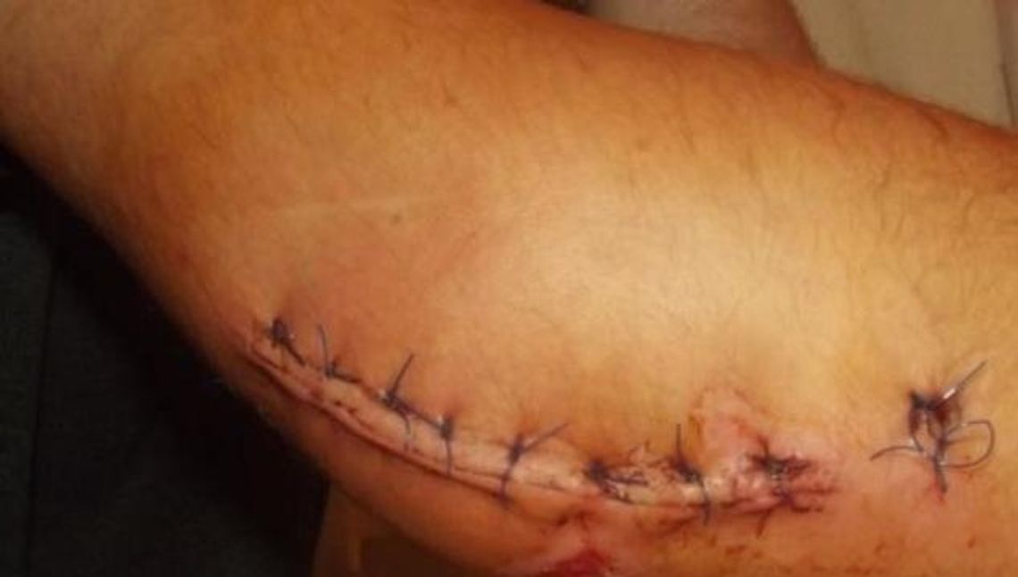 Nasza interwencja: wystający krawężnik naprawiony! Nikt już się nie przewróci Nasza interwencja: wystający krawężnik naprawiony! Nikt już się nie przewróci